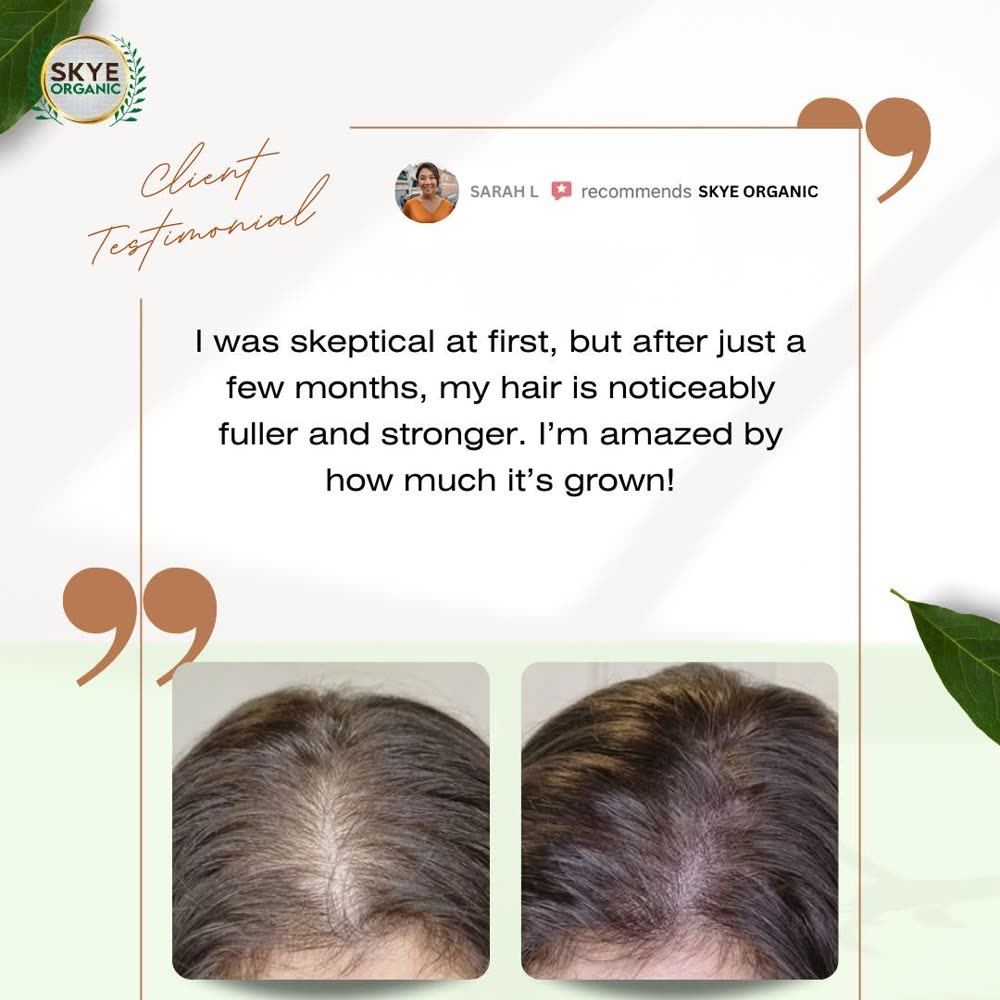 Client testimonial with scalp before and after treatment